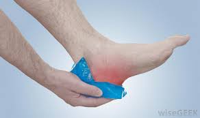 Applying Ice Therapy Over Heel Area
