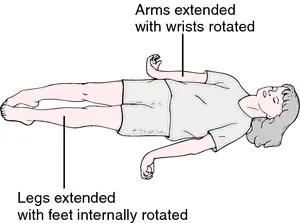 Extensor synergy in upper and lower limb
