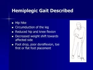 Hemiplegic Gait