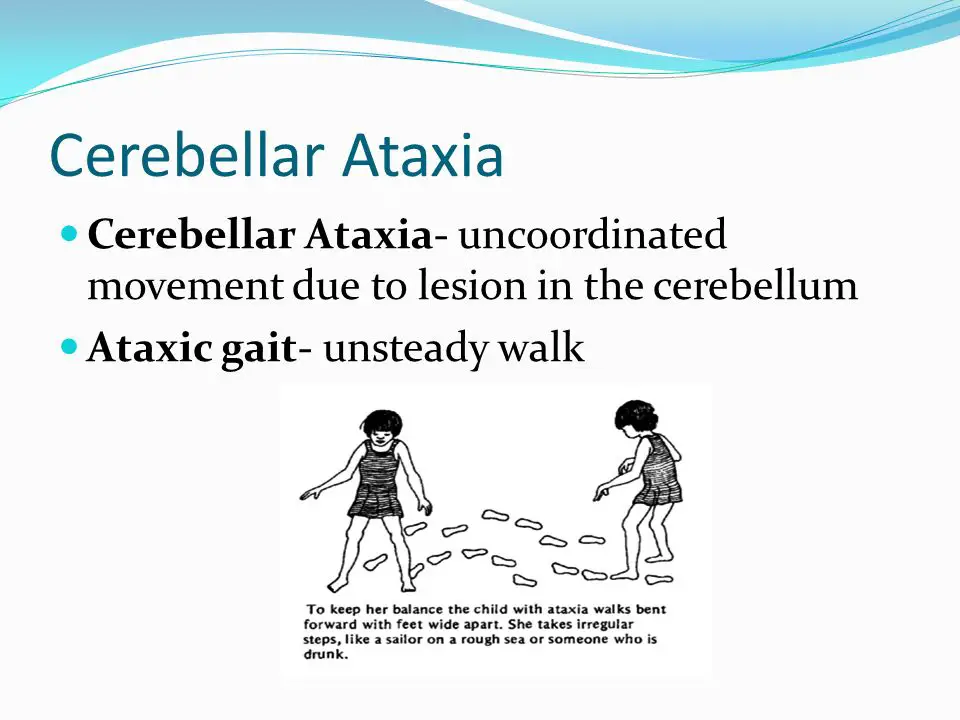 Ataxia Cause, Sign And Symptoms, Diagnosis, Treatment