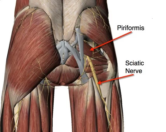 Anatomy of piriformis syndrome