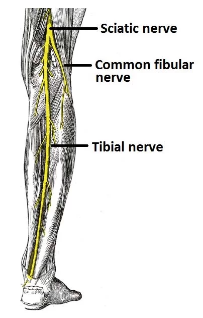 Tibial Nerve Injury