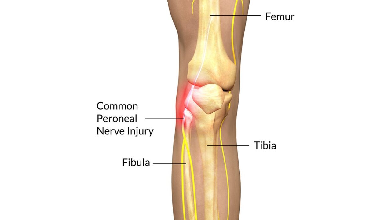 common peroneal nerve