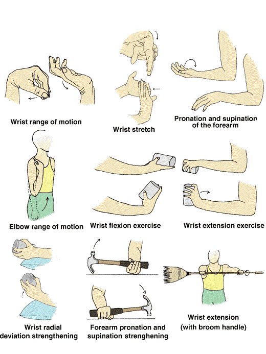 Tennis Elbow Exercise