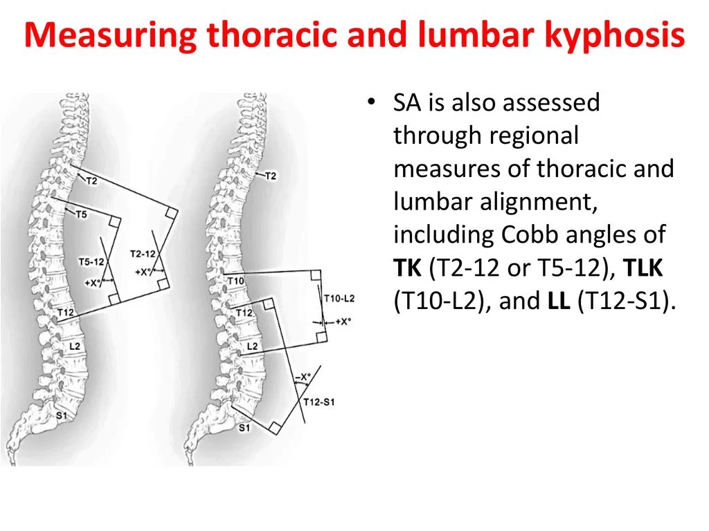 Thoracic kyphosis is measurement