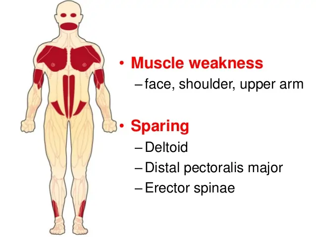 Oculopharyngeal muscular dystrophy (OPMD)