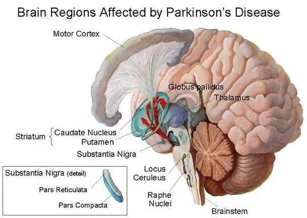 Brain Affected in Parkinsons disease