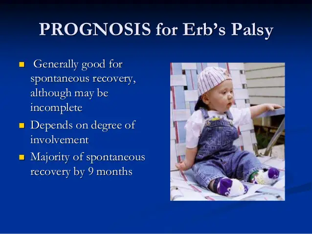 Prognosis-erb’s-palsy