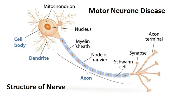 Motor Neurone Disease (MND)