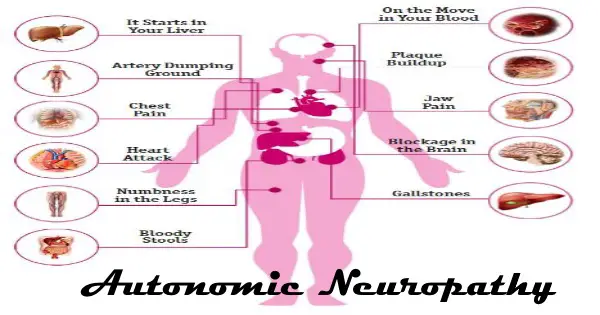 Autonomic-Neuropathy