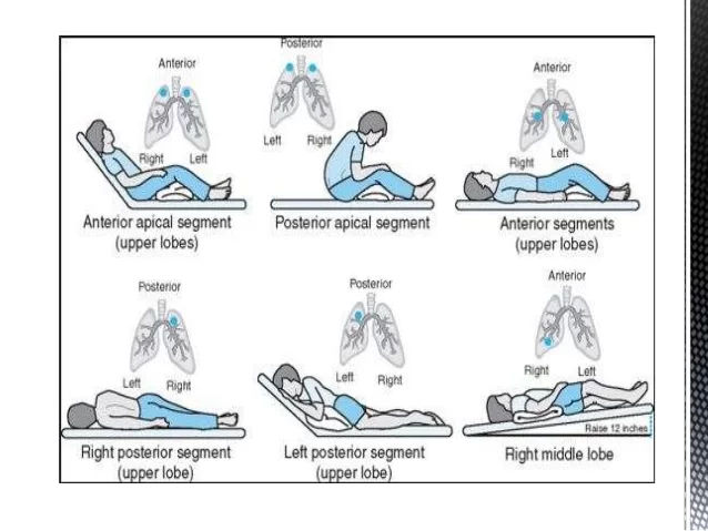 POSTURAL-DRAINAGE-POSITIONS