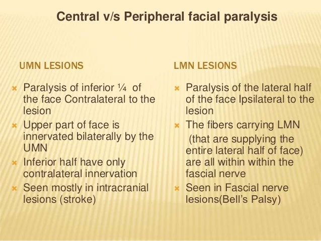 Facial nerve palsy LMN AND UMN LESION