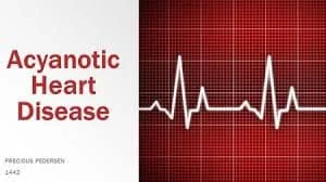 ACYANOTIC CONGENITAL HEART DISEASE