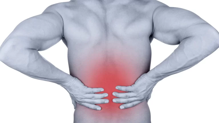 Low Back Pain: Physiotherapy Management