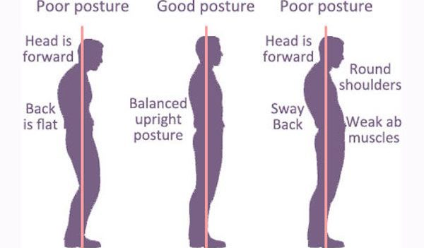 abnormal-posture-type-cause-symptom-s-exercise