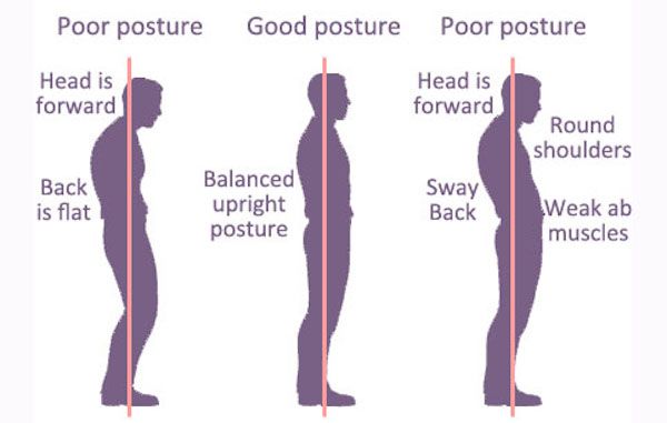 Bad Posture-Good Posture