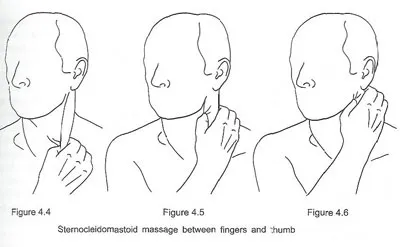 Strernocleidomastiod massage