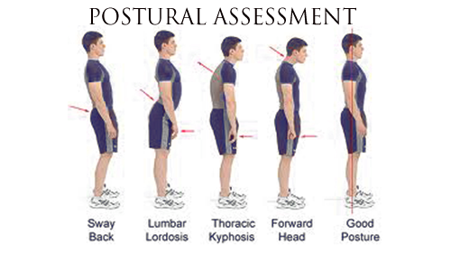 Abnormal posture detail