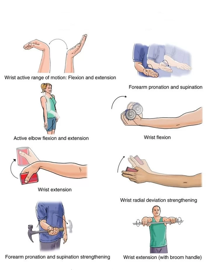 14 Best Home Exercise for Wrist Drop - Mobile Physio