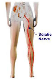 Sciatic nerve Anatomy