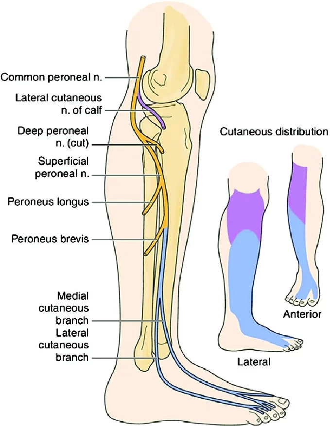 Common Peroneal Nerve Origin Course Branches