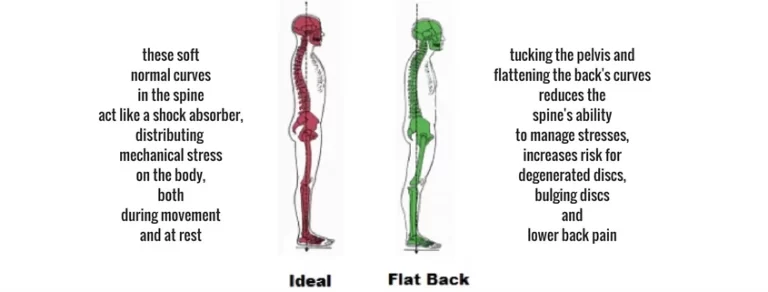 Flatback Posture