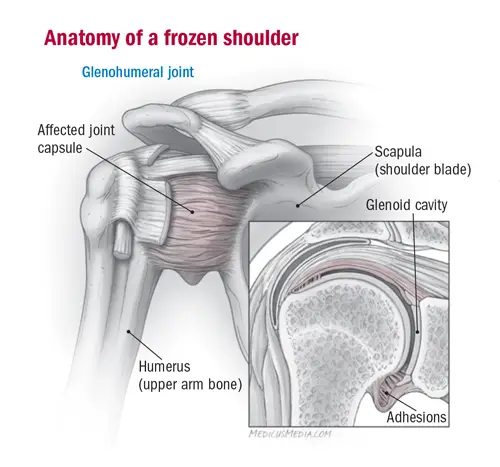 Frozen Shoulder Anatomy