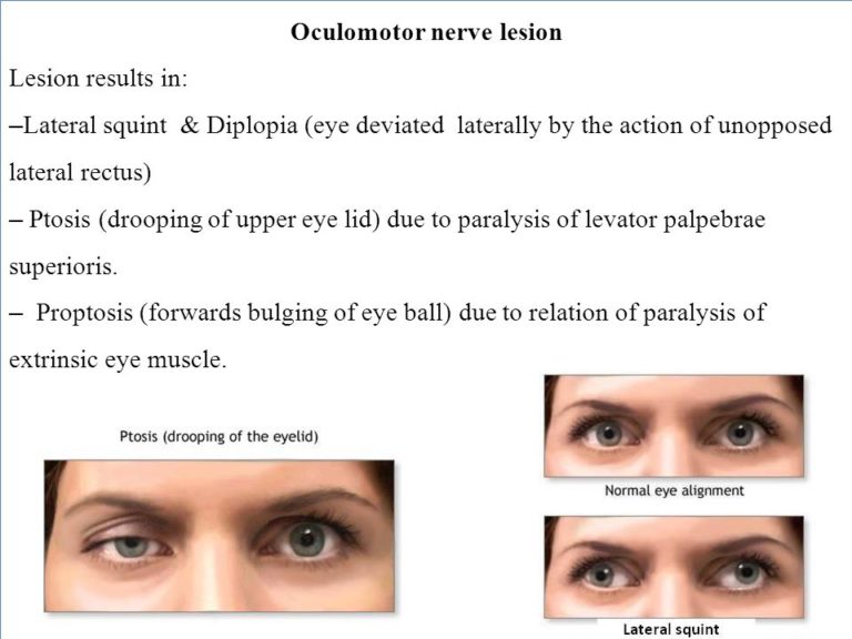 Oculomotor nerve : anatomy, origin, course & branches