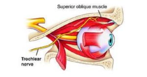 Trochlear nerve : origin, anatomy, course & branches