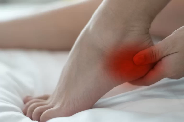 Heel Pain and Physiotherapy Treatment