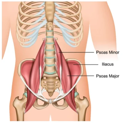 Psoas syndrome and Physiotherapy management