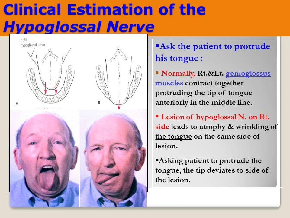 Clinical Estimation of the Hypoglossal Nerve