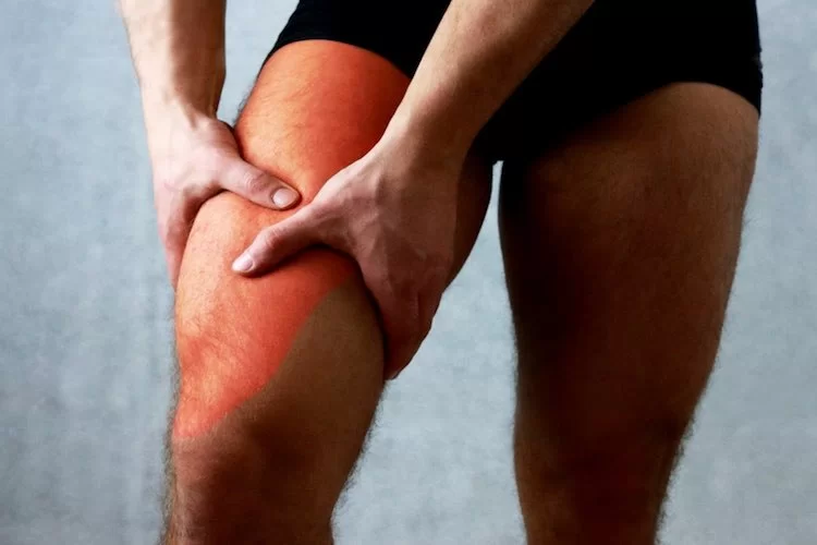 Quadriceps Contusion & Physiotherapy management