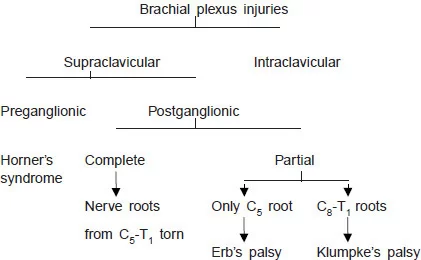 Classification of Brachial Plexus injury