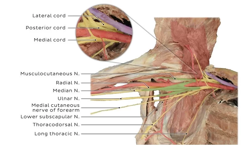 Mechanism of Injury of Brachial Plexus