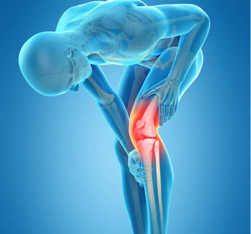 TOTAL KNEE REPLACEMENT : Physiotherapy Management