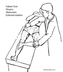 GLUTEAL TENDINOPATHY: Physiotherapy Treatment