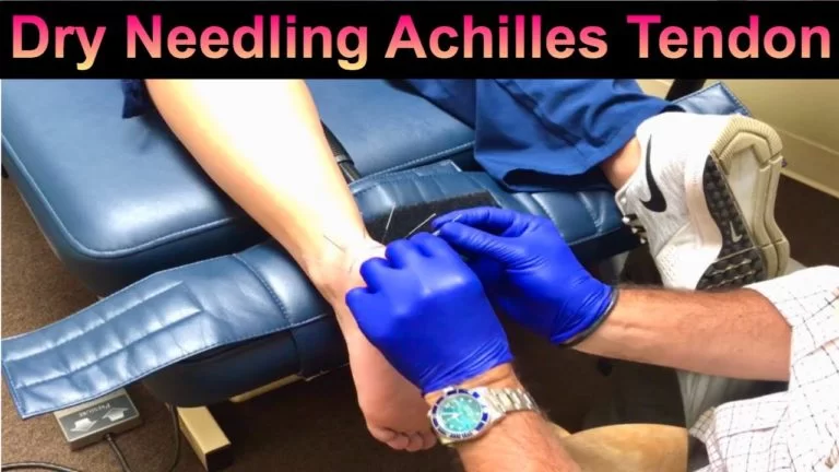 dry needing achilles tendon