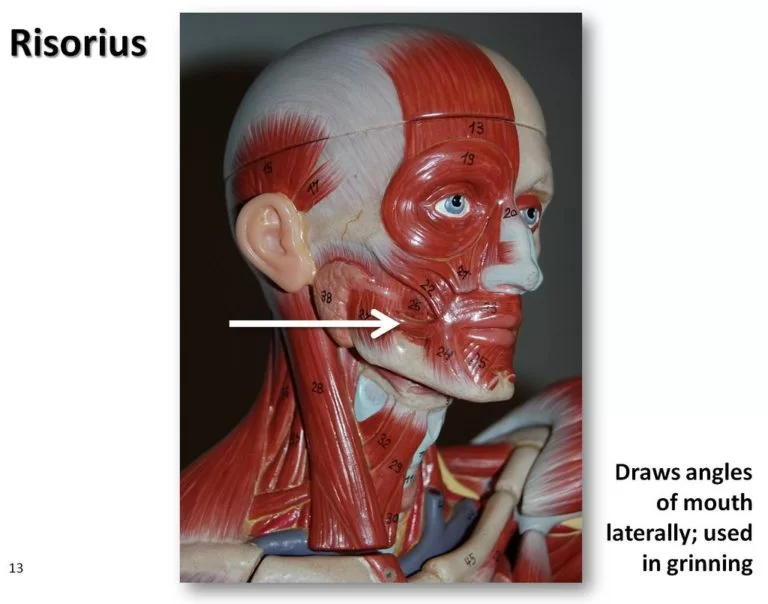 Risorius muscle