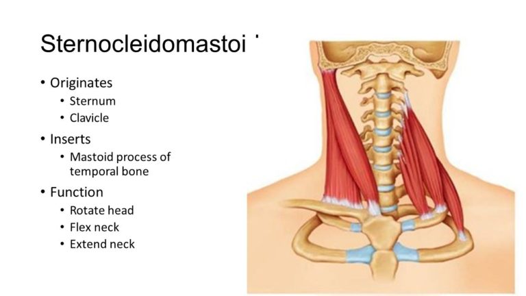 Sternocleidomastoid Mobile Physiotherapy Clinic Ahmedabad Gujarat 2133
