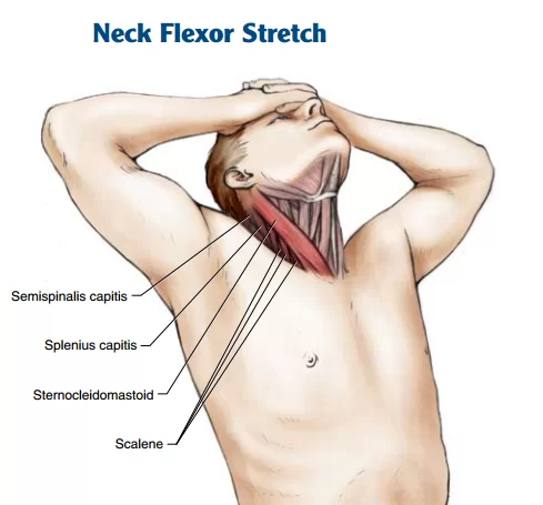Neck Flexor Stretch