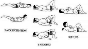 The Above Knee Amputations : Indication, Physiotherapy, Prosthesis