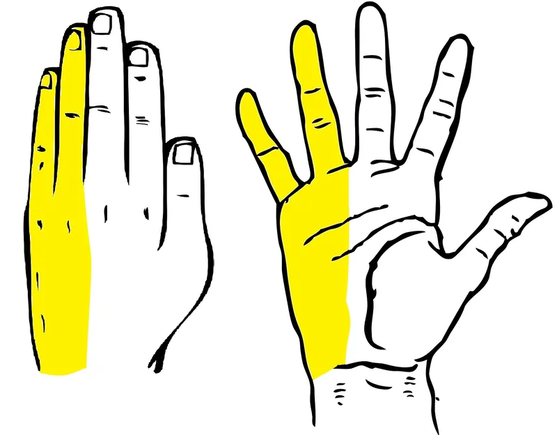 classic ulnar sensory distribution