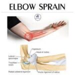 Elbow Pain: Causes, Diagnosis, Physiotherapy Treatment, Exercise