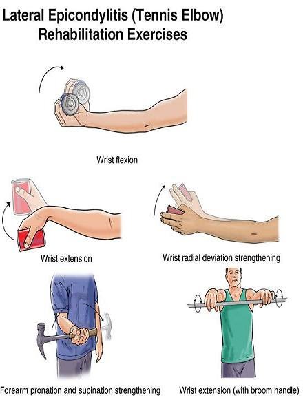 Elbow Pain: Causes, Diagnosis, Physiotherapy Treatment, Exercise