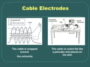 Cable method