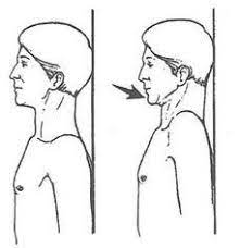 Chin Tuck Exercise