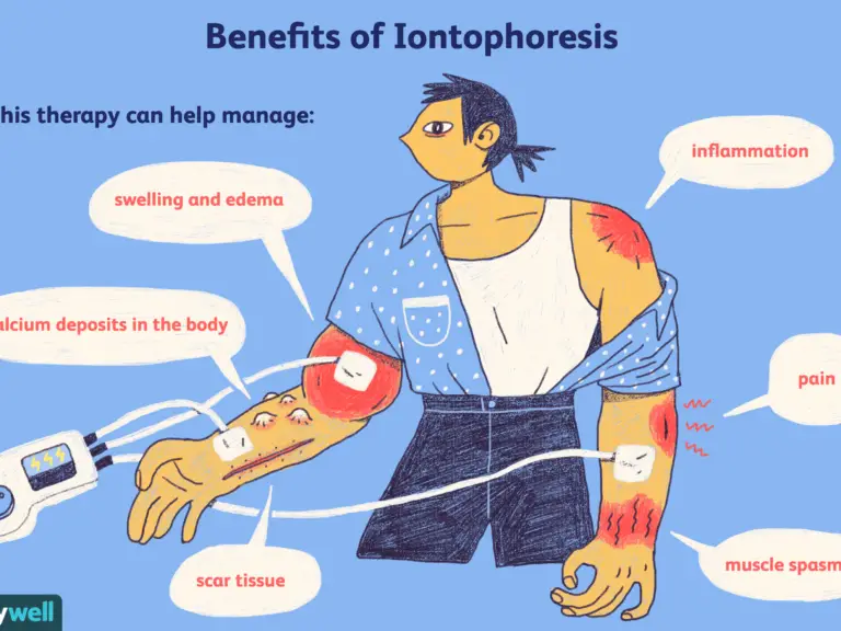 Benefit of the iontophoresis