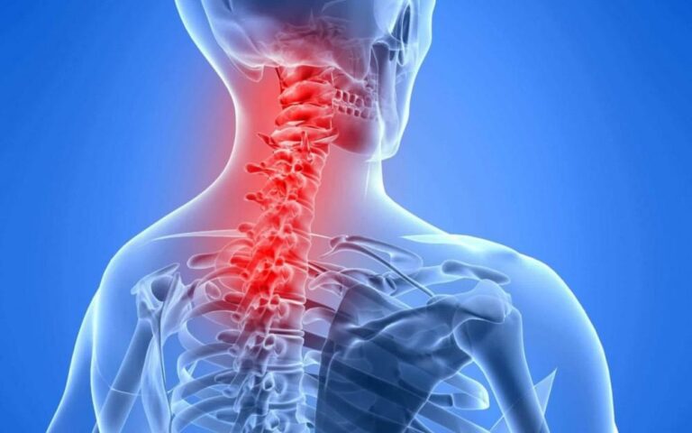 Neck pain: Cause, Symptoms, Diagnosis, Treatment, Exercise