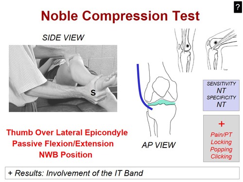 Noble compression test